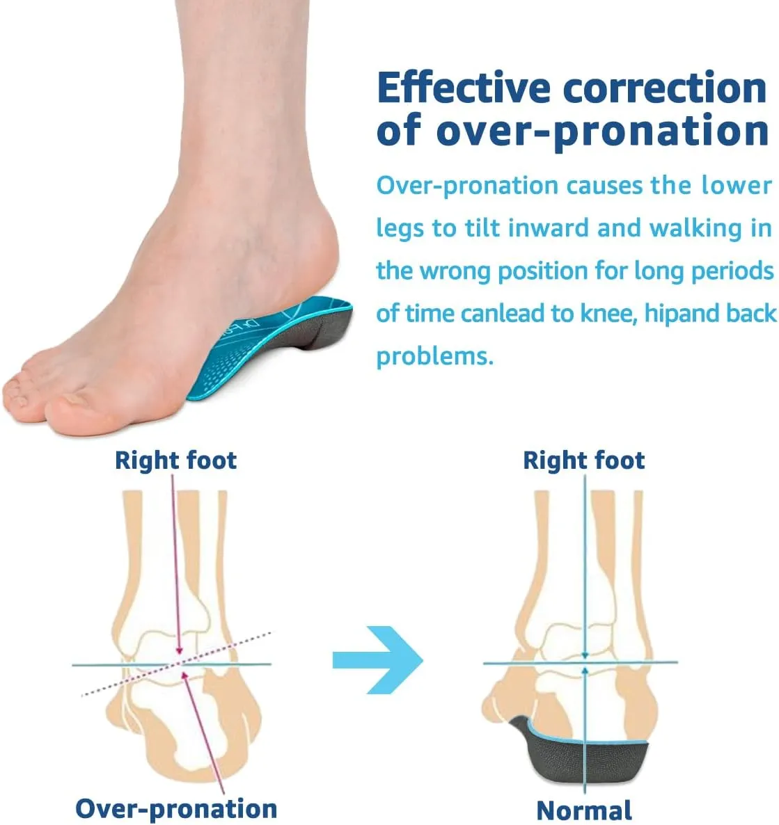3/4 Orthotic Insoles, Shoe Inserts for Plantar Fasciitis Relief, High Arch Support Inserts for Flat Feet, Over-Pronation and Heel Pain (Medium(Men's 6.5-8.5 / Women's 7.5-9.5))